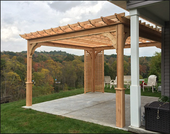 Customer's Photo - 14' x 14' Cedar Belvedere Pergola